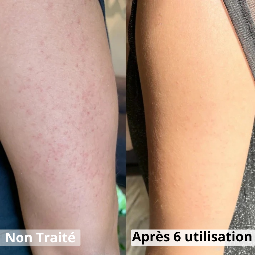 KeraCur Lissant Éclat – Peau Douce & Unie