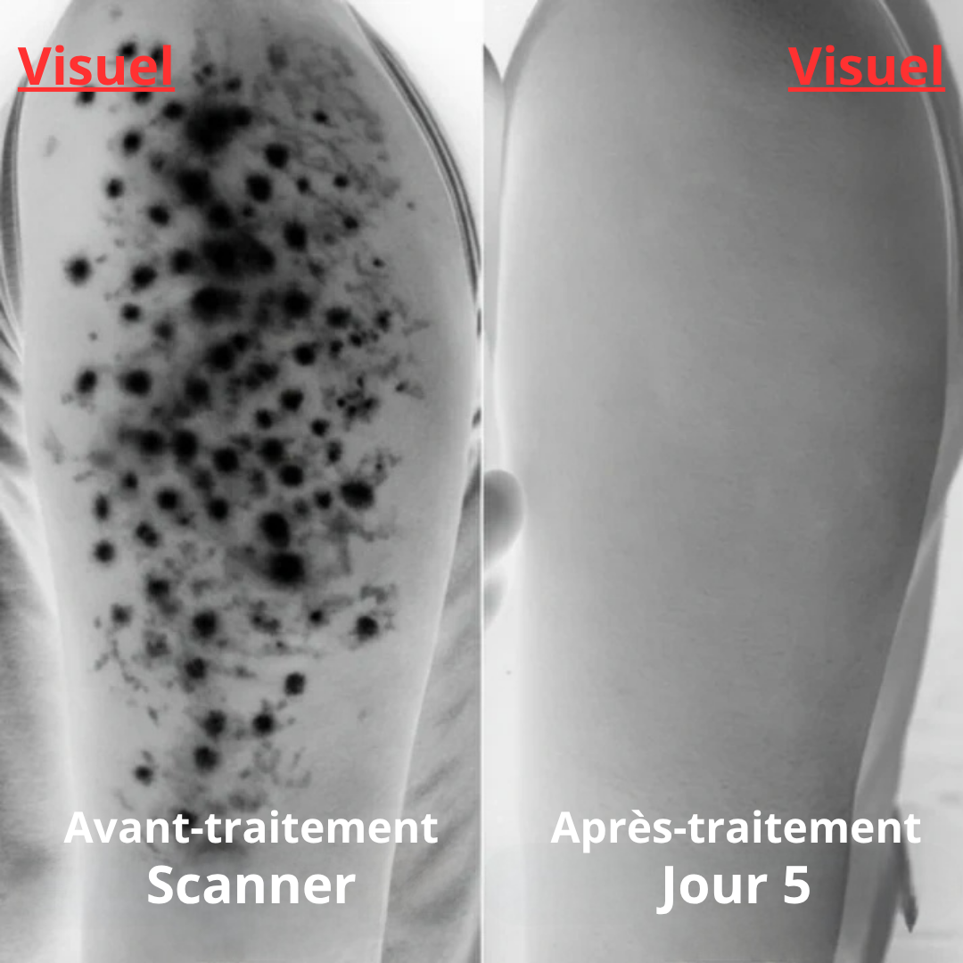 KeraCur Lissant Éclat – Peau Douce & Unie